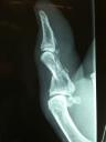 thumb x-ray before